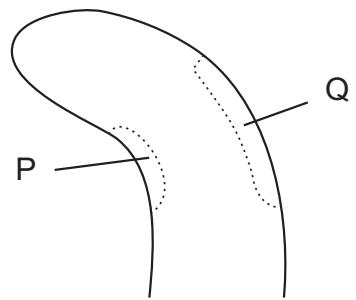 Exam diagram